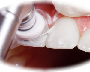 Dentista Milano Abruzzi Lima Igiene E Prevenzione