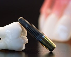 Dentista Milano Abruzzi Lima Implantologia