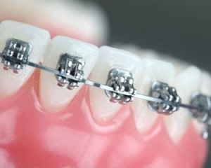 Dentista Milano Abruzzi Lima Ortondonzia