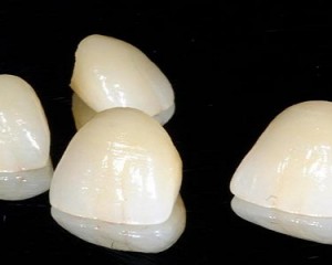 Dentista Milano Abruzzi Lima Protesi Dentaria